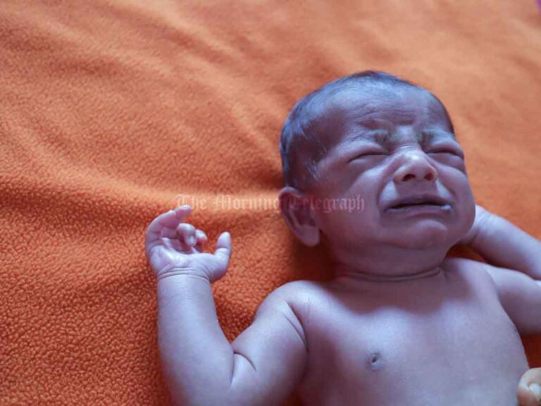 First Case of Rare Genetic Disease Found in Sri Lanka: Baby's Body Turns Blue