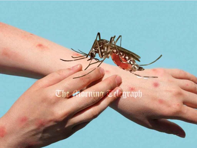 Chikungunya Spreading Fast; Are You at Risk?